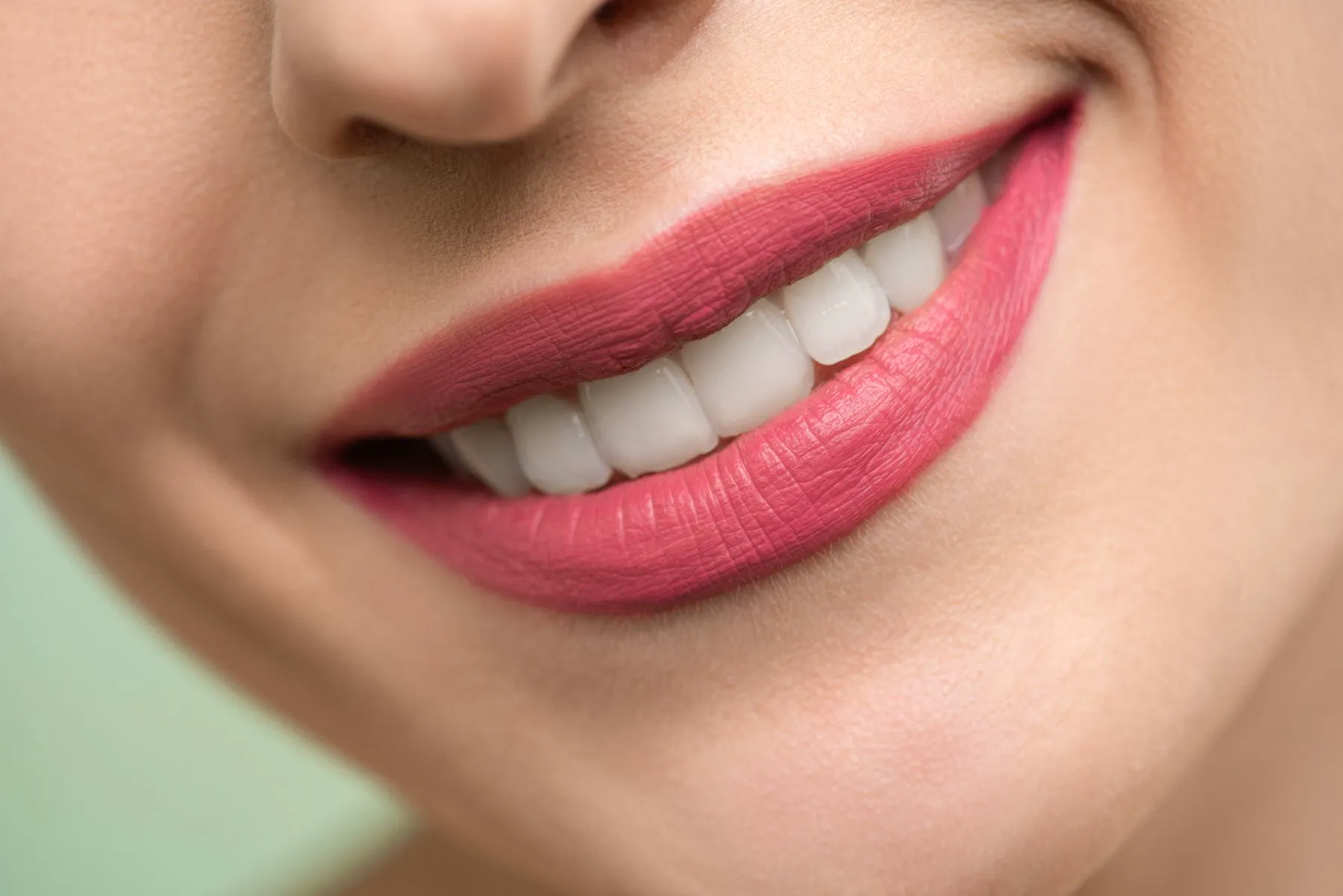 After: a bright, clean smile